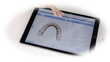 Planning based on digital 3D modeling and digital X-Rays of your teeth